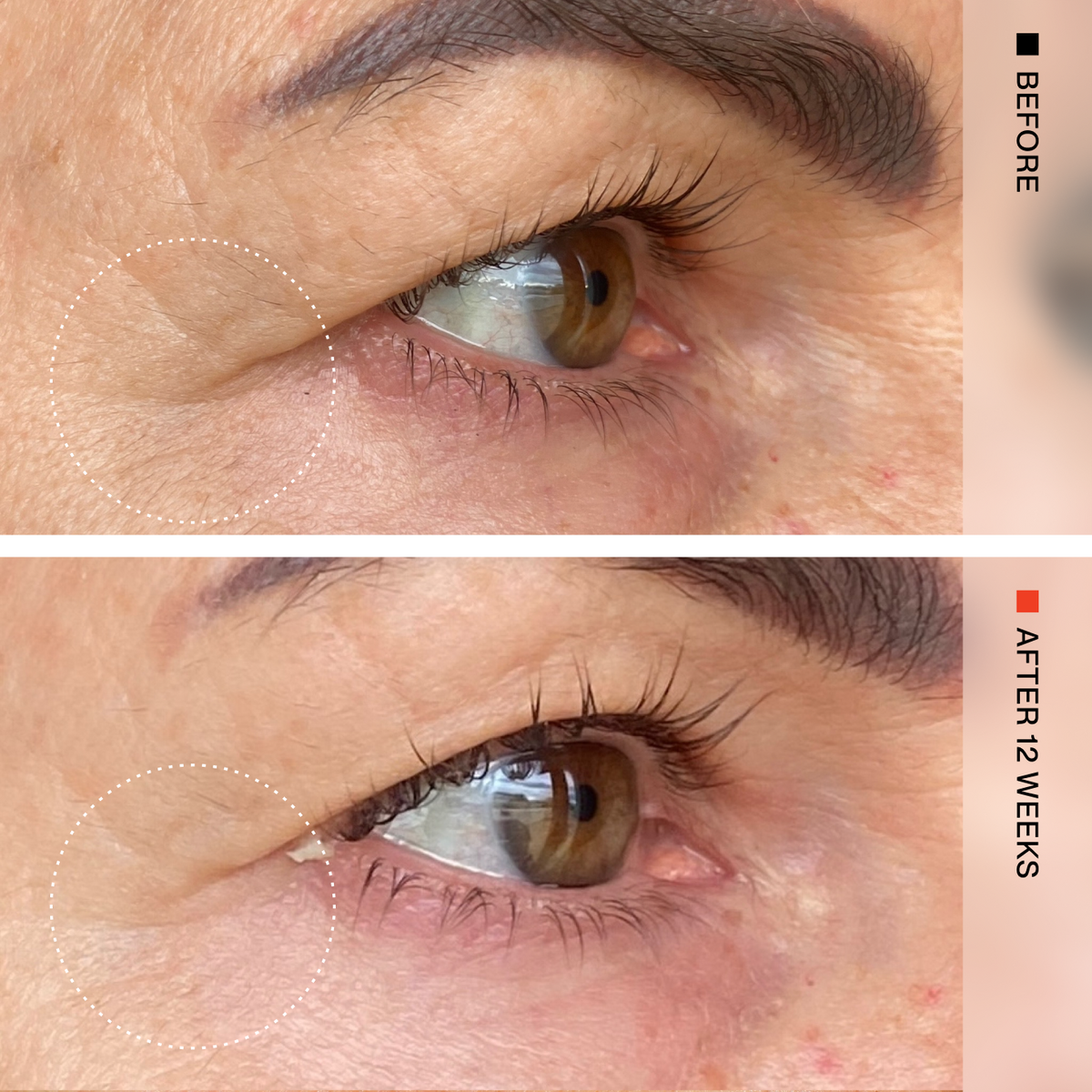 Before-and-after comparison of a person's eye area showing skin texture and wrinkles around the eye, with text reading 'BEFORE' and 'AFTER 12 WEEKS' on a beige sidebar.